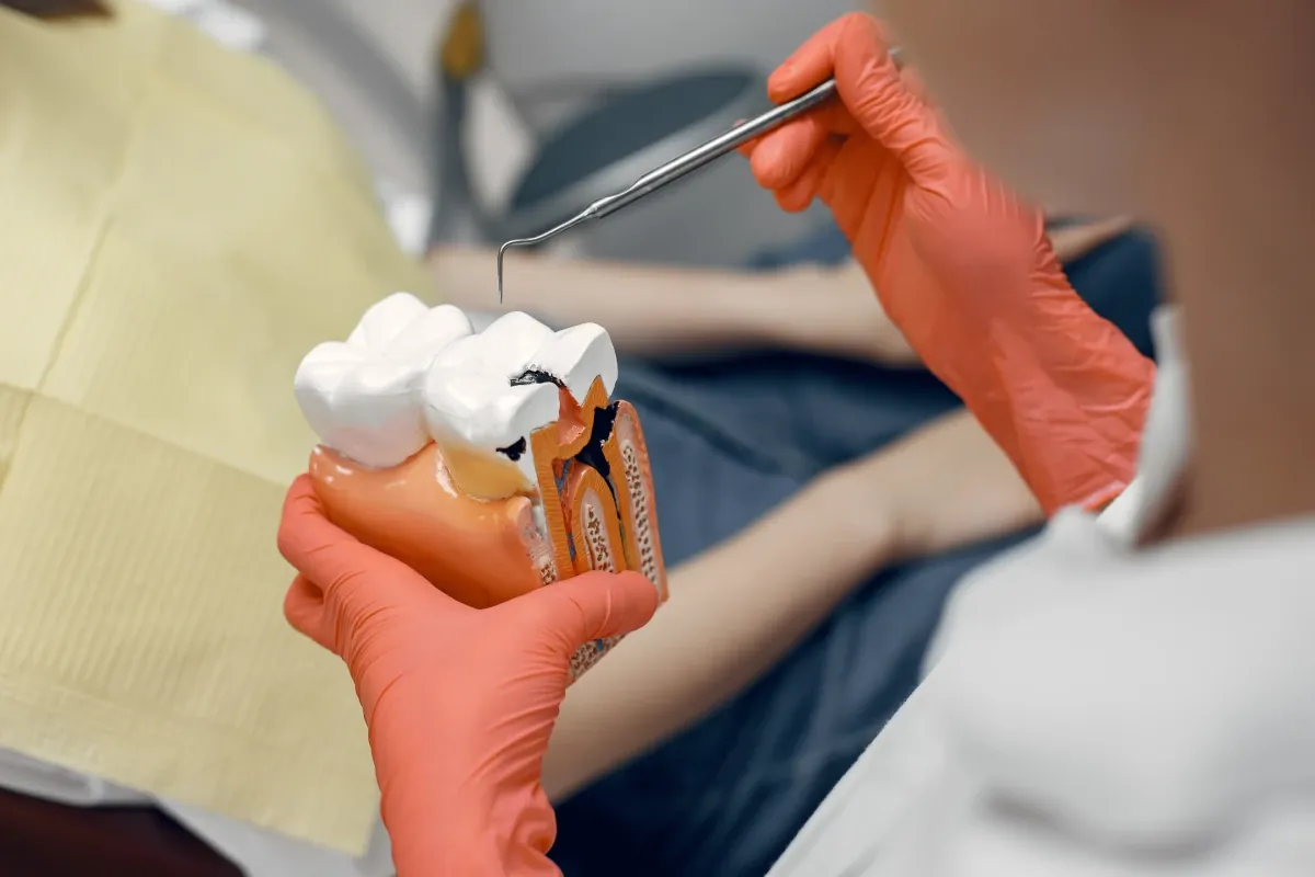 Odontóloga mostrando en un modelo dental un diente con caries profunda