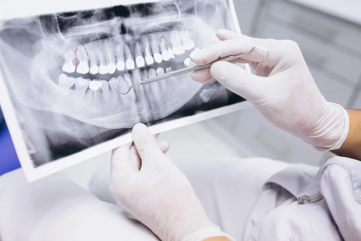 Odontólogo revisando una radiografía panorámica antes de planificar una prótesis dental