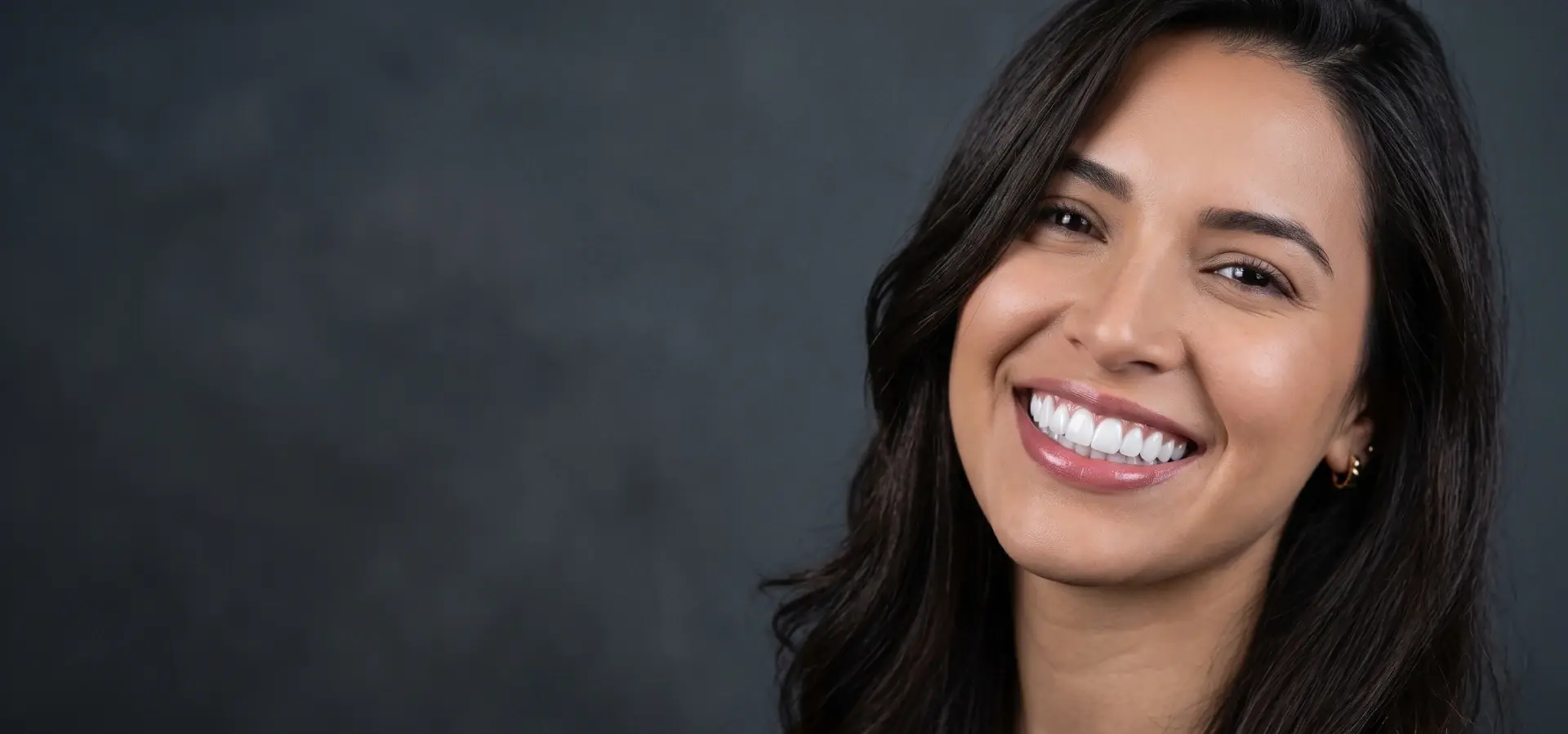 Mujer con una sonrisa blanca y natural después de un tratamiento de estética dental